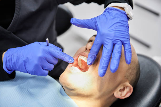 Best Emergency Tooth Extraction in Girard, OH